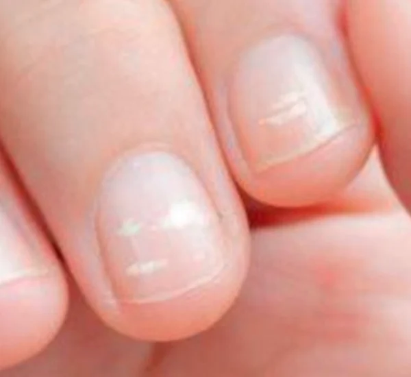 Uñas por envejecimiento: Causas y soluciones